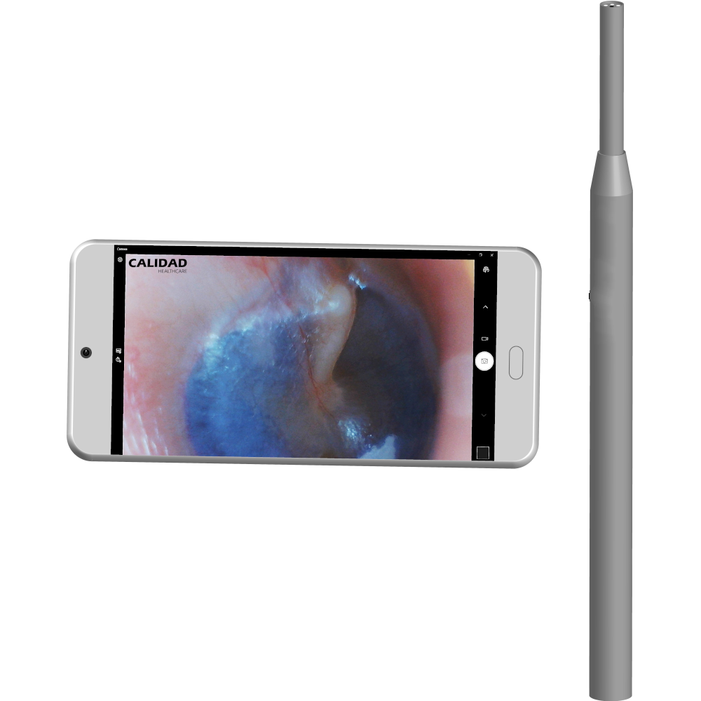 Digital Otoscope